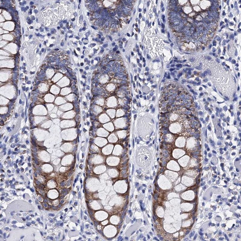 ACADSB Antibody - BSA Free Immunohistochemistry-Paraffin: ACADSB Antibody [NBP2-48739]
