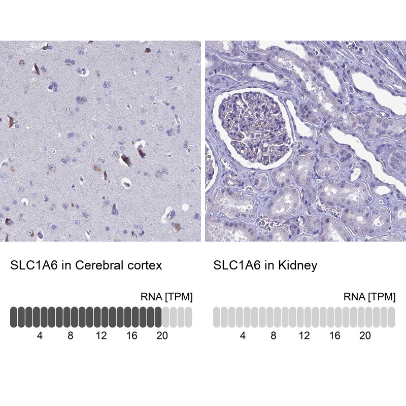 EAAT4 Antibody - BSA Free Immunohistochemistry-Paraffin: EAAT4 Antibody [NBP2-48740]
