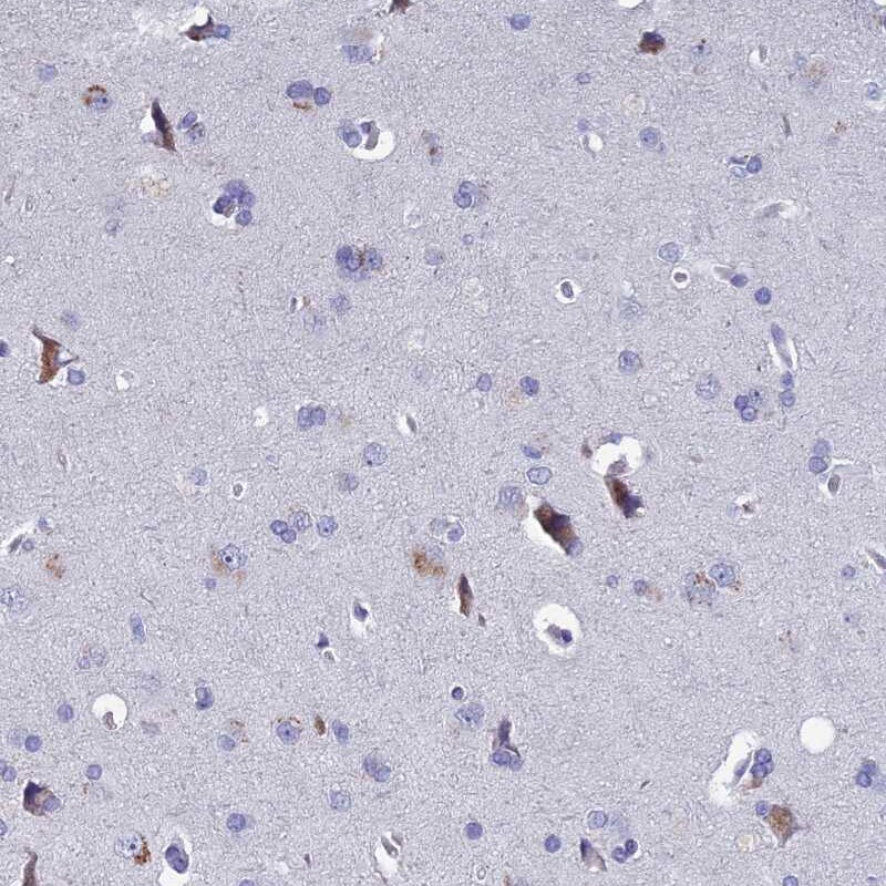 EAAT4 Antibody - BSA Free Immunohistochemistry-Paraffin: EAAT4 Antibody [NBP2-48740]