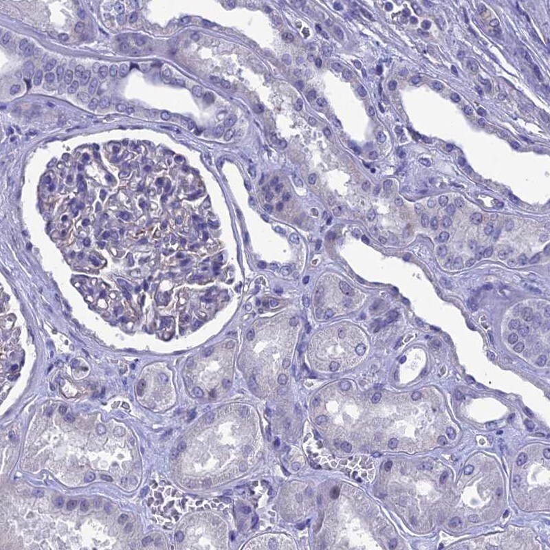 EAAT4 Antibody - BSA Free Immunohistochemistry-Paraffin: EAAT4 Antibody [NBP2-48740]