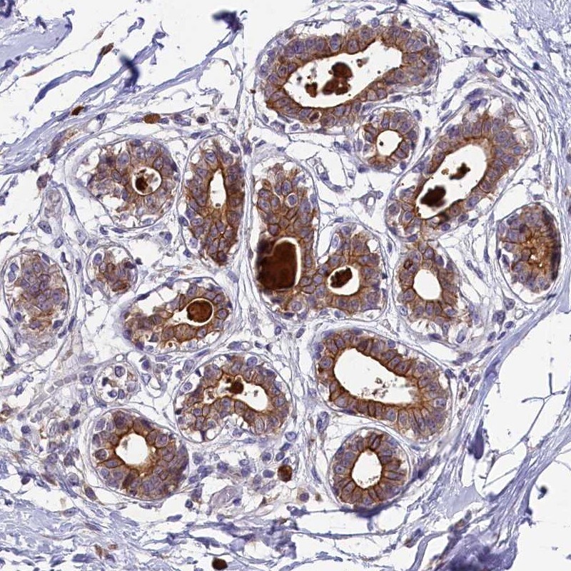 ABCC10 Antibody - BSA Free Immunohistochemistry: ABCC10 Antibody - BSA Free [NBP2-48743]