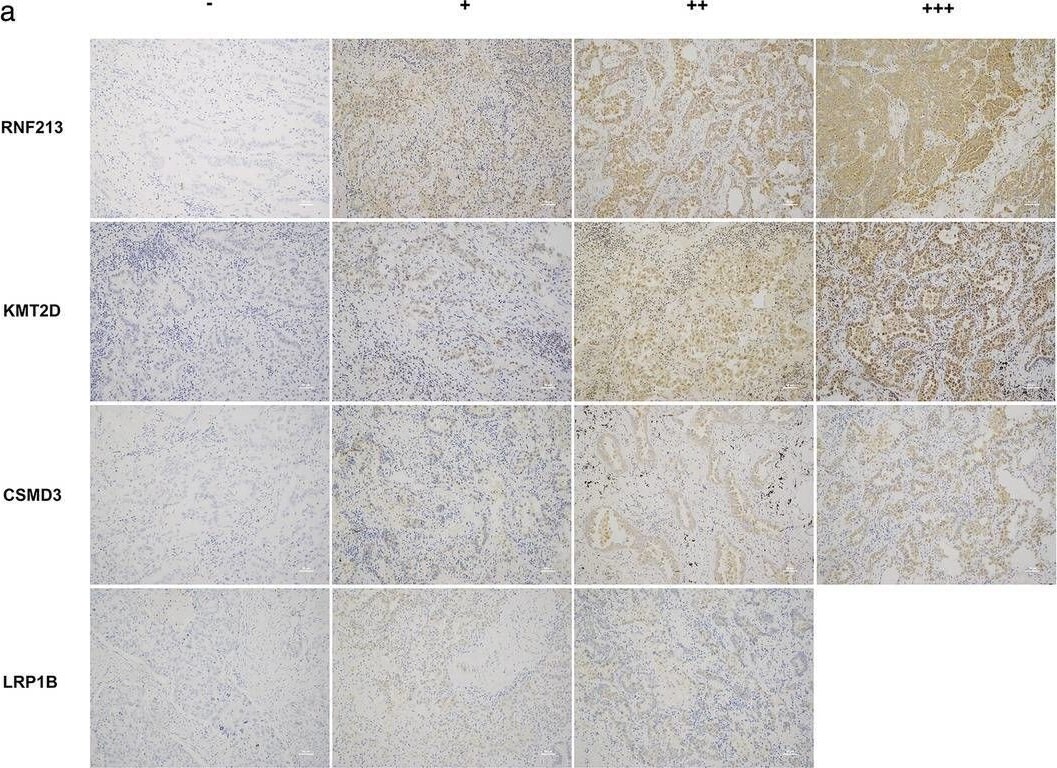 LRP-1B Antibody - BSA Free