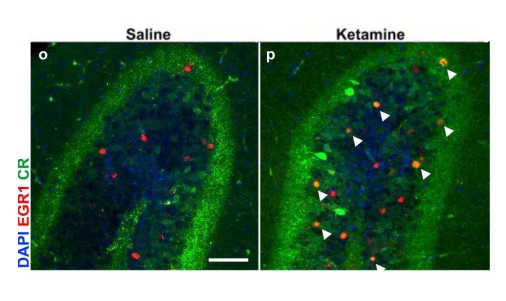 Calretinin Antibody