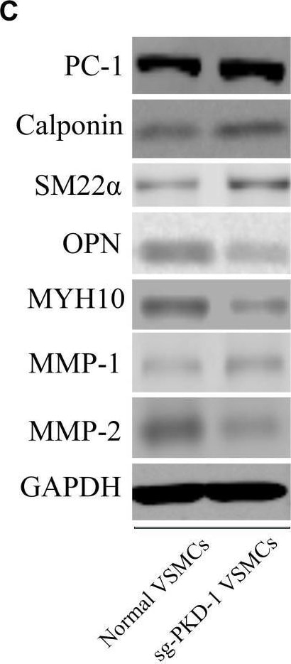 Polycystin-1/PKD1 Antibody (PKS161f/B7) - BSA Free