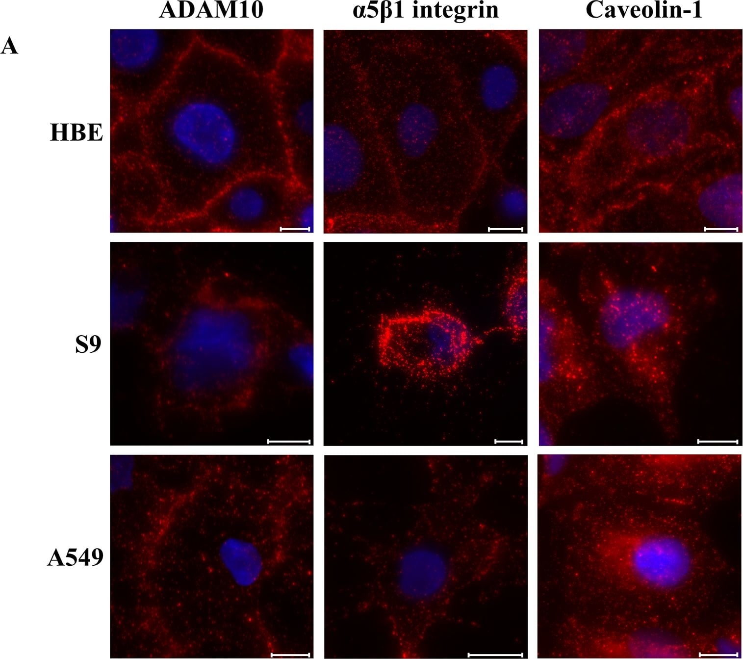 Integrin alpha 5 beta 1 Antibody (M200 (Volociximab)) - Chimeric - Azide and BSA Free