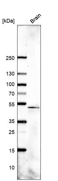 SOX11 Antibody (CL0143) - BSA Free Western Blot: SOX11 Antibody (CL0143) [NBP3-52442]