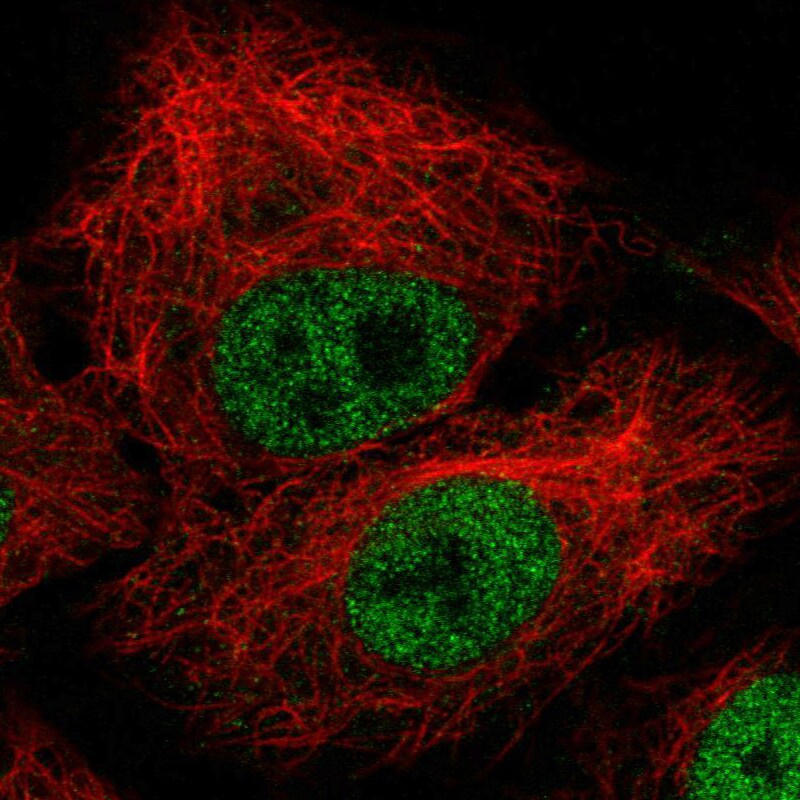 ZEB1 Antibody (CL0151) - BSA Free Immunocytochemistry/ Immunofluorescence: ZEB1 Antibody (CL0151) [NBP2-52866]