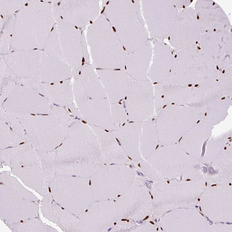 SIX1 Antibody (CL0185) - BSA Free Immunohistochemistry-Paraffin: SIX1 Antibody (CL0185) [NBP2-52873]