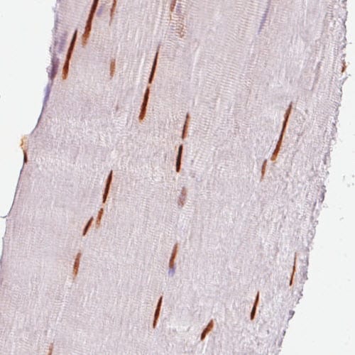 SIX1 Antibody (CL0185) - BSA Free Immunohistochemistry-Paraffin: SIX1 Antibody (CL0185) [NBP2-52873]