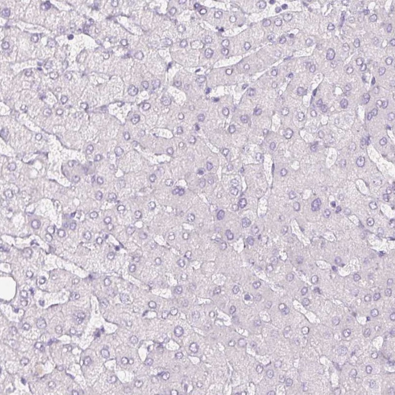 SIX1 Antibody (CL0185) - BSA Free Immunohistochemistry-Paraffin: SIX1 Antibody (CL0185) [NBP2-52873]