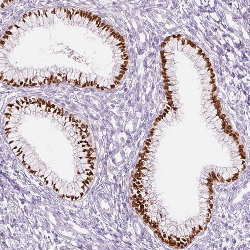SIX1 Antibody (CL0185) - BSA Free Immunohistochemistry-Paraffin: SIX1 Antibody (CL0185) [NBP2-52873]