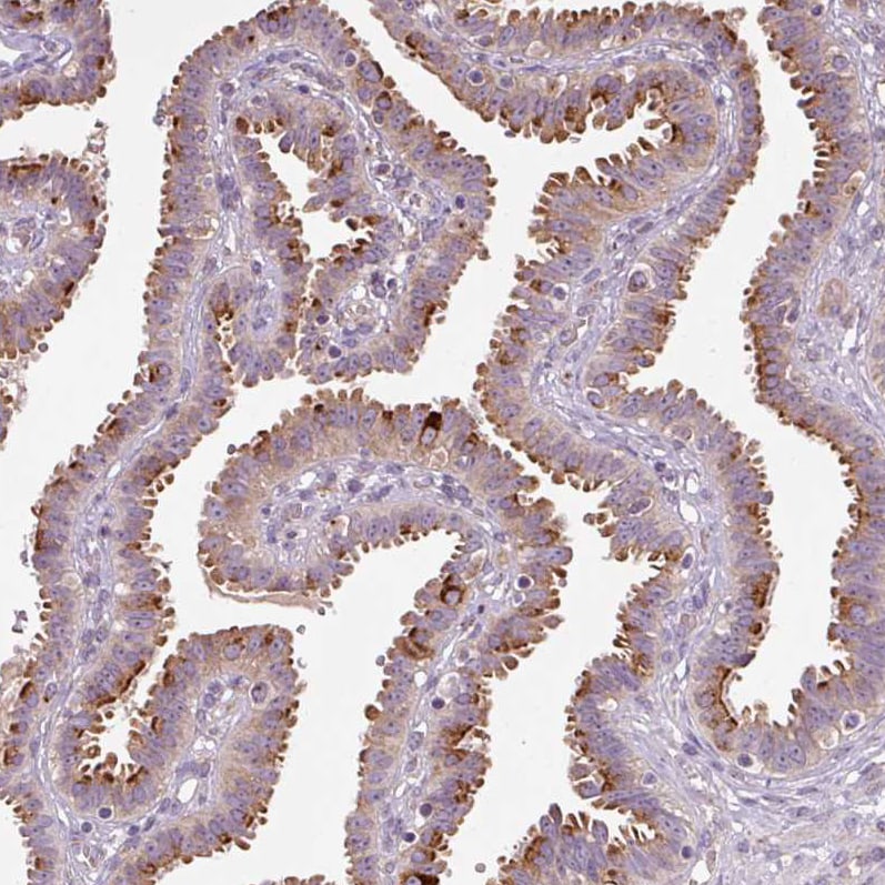 PCM1 Antibody (CL0206) - BSA Free Immunohistochemistry: PCM1 Antibody (CL0206) [NBP3-52444]