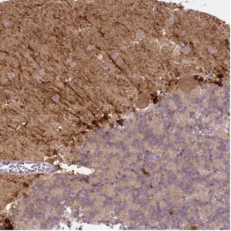 FABP7/B-FABP Antibody (CL0236) FABP7/B-FABP Antibody (CL0236)