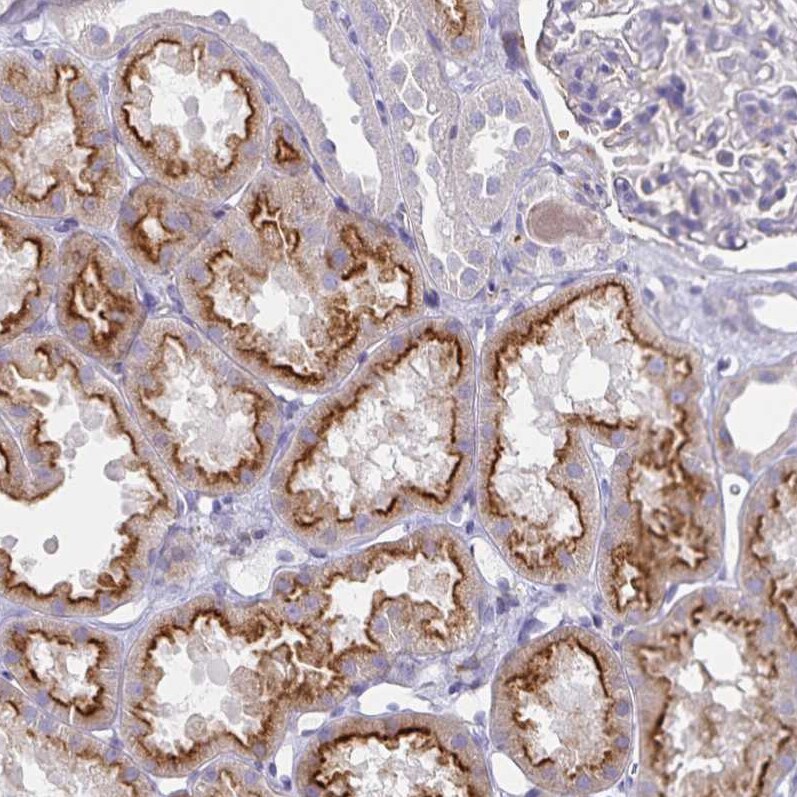 Syntaxin 7 Antibody (CL0257) - BSA Free Immunohistochemistry: Syntaxin 7 Antibody (CL0257) [NBP3-52445]