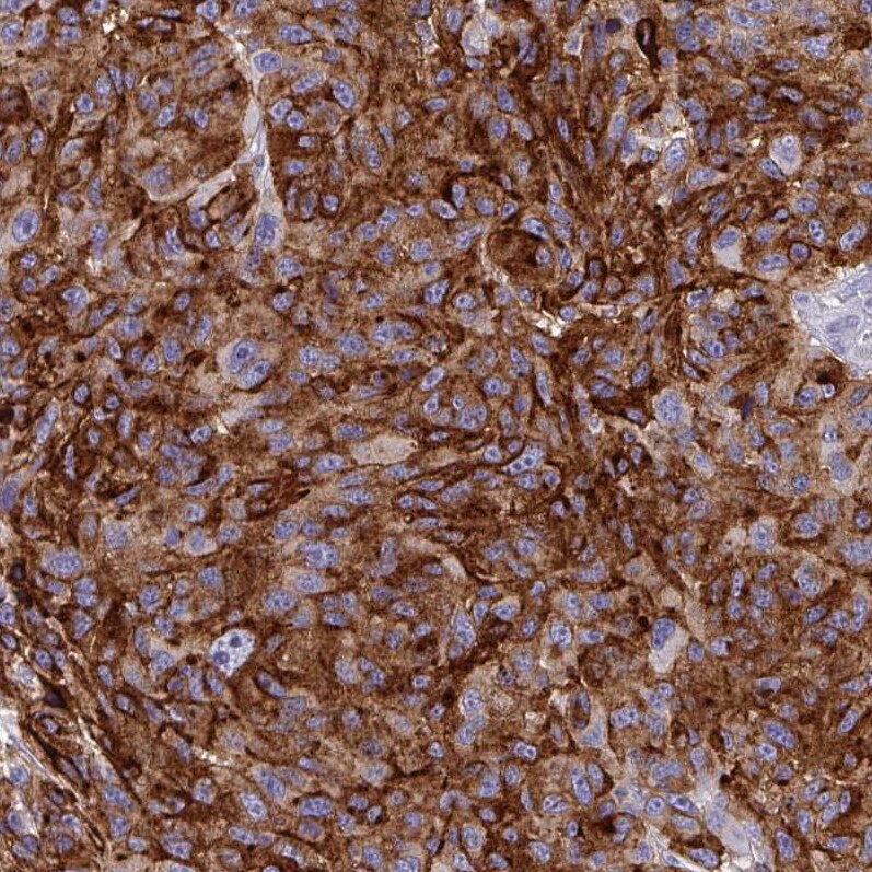 Syntaxin 7 Antibody (CL0257) - BSA Free Immunohistochemistry: Syntaxin 7 Antibody (CL0257) [NBP3-52445]