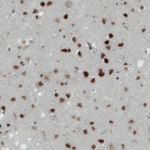MEF2C Antibody (CL0368) - BSA Free Immunohistochemistry: MEF2C Antibody (CL0368) - BSA Free [NBP2-52925]