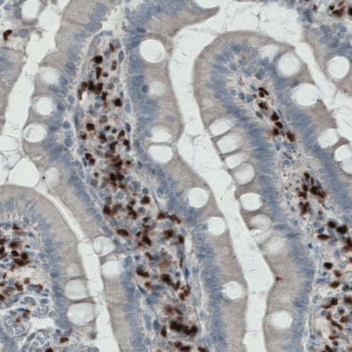 MEF2C Antibody (CL0368) - BSA Free Immunohistochemistry: MEF2C Antibody (CL0368) - BSA Free [NBP2-52925]