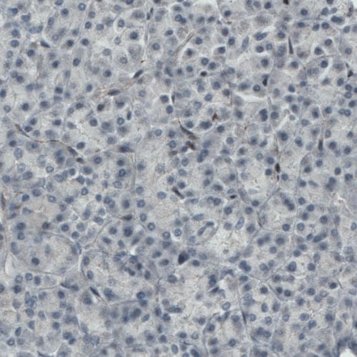 MEF2C Antibody (CL0368) - BSA Free Immunohistochemistry: MEF2C Antibody (CL0368) - BSA Free [NBP2-52925]