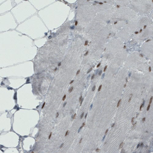 MEF2C Antibody (CL0368) - BSA Free Immunohistochemistry: MEF2C Antibody (CL0368) - BSA Free [NBP2-52925]