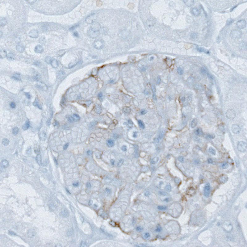 PLA2R1 Antibody (CL0474) - BSA Free Immunohistochemistry: PLA2R1 Antibody (CL0474) - BSA Free [NBP2-52933]