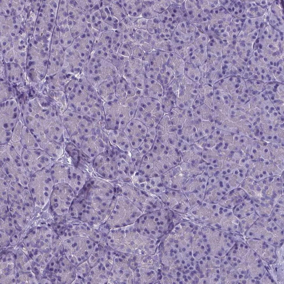 PLA2R1 Antibody (CL0474) - BSA Free Immunohistochemistry: PLA2R1 Antibody (CL0474) - BSA Free [NBP2-52933]