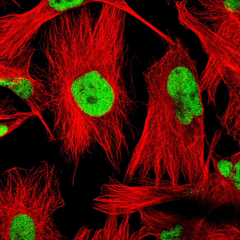 SOX9 Antibody (CL0639) - BSA Free Immunocytochemistry/ Immunofluorescence: SOX9 Antibody (CL0639) [NBP2-52943]