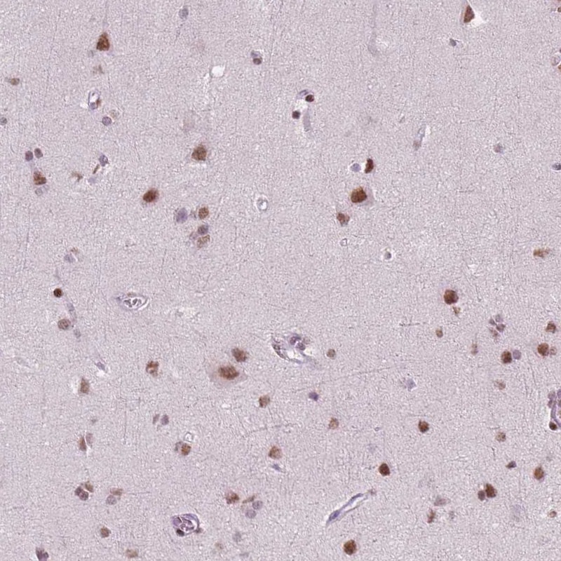 BRD4 Antibody (CL1115) - BSA Free Immunohistochemistry: BRD4 Antibody (CL1115) [NBP3-52453]