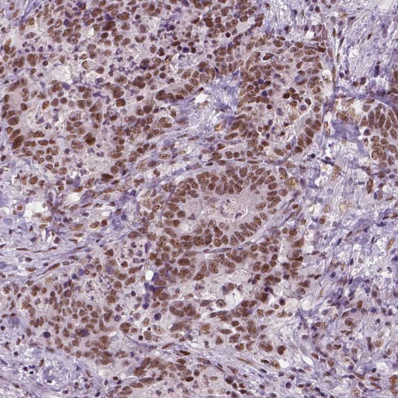 BRD4 Antibody (CL1115) - BSA Free Immunohistochemistry: BRD4 Antibody (CL1115) [NBP3-52453]