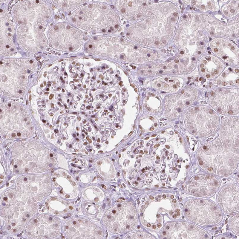 BRD4 Antibody (CL1115) - BSA Free Immunohistochemistry: BRD4 Antibody (CL1115) [NBP3-52453]