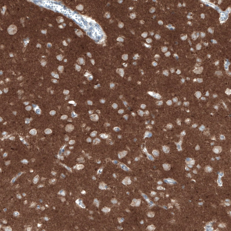 CD90/Thy1 Antibody (CL1028) - BSA Free Immunohistochemistry: CD90/Thy1 Antibody (CL1028) - BSA Free [NBP2-52960]