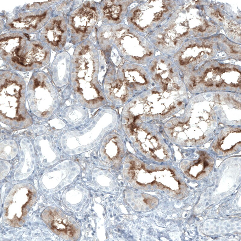 CD90/Thy1 Antibody (CL1028) - BSA Free Immunohistochemistry: CD90/Thy1 Antibody (CL1028) - BSA Free [NBP2-52960]