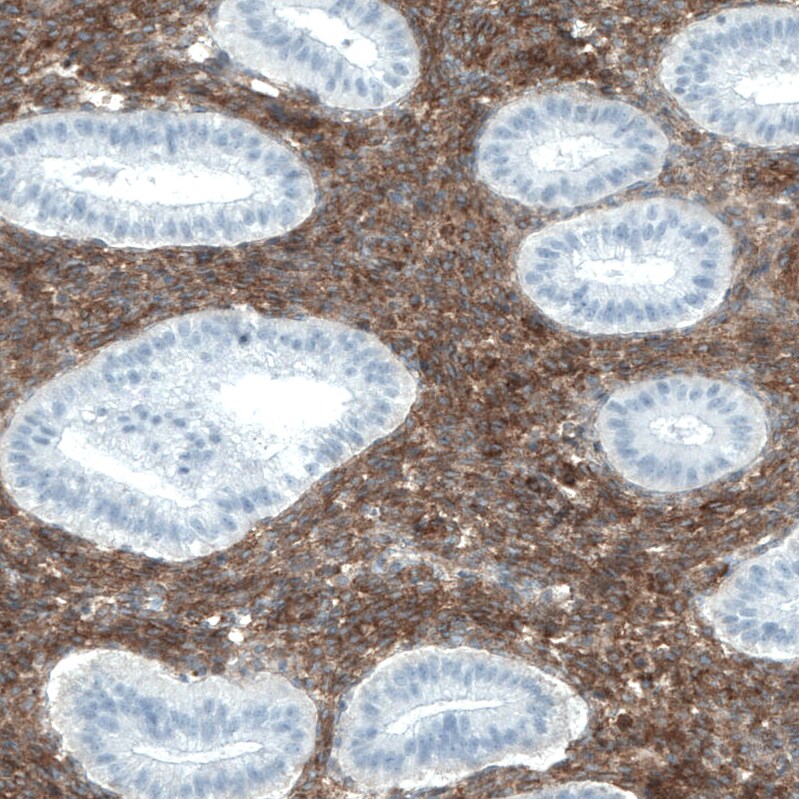 CD90/Thy1 Antibody (CL1028) - BSA Free Immunohistochemistry: CD90/Thy1 Antibody (CL1028) - BSA Free [NBP2-52960]