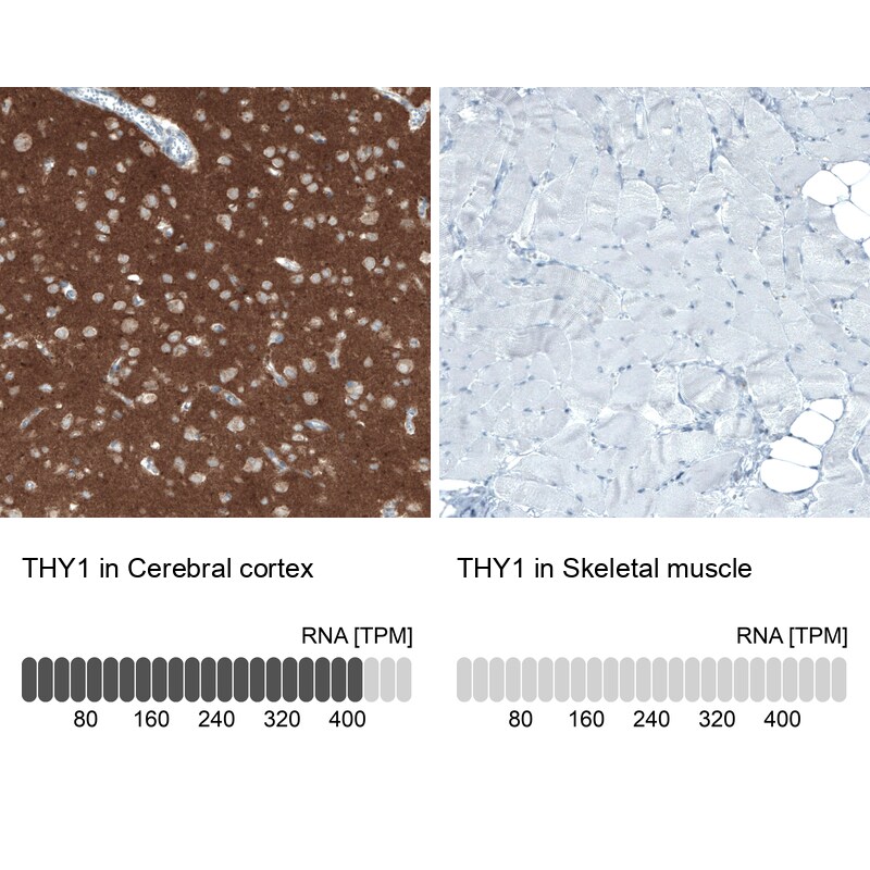 CD90/Thy1 Antibody (CL1028) - BSA Free Immunohistochemistry: CD90/Thy1 Antibody (CL1028) - BSA Free [NBP2-52960]