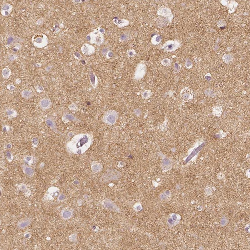 CD90/Thy1 Antibody (CL1040) - BSA Free Immunohistochemistry: CD90/Thy1 Antibody (CL1040) - BSA Free [NBP2-52961]