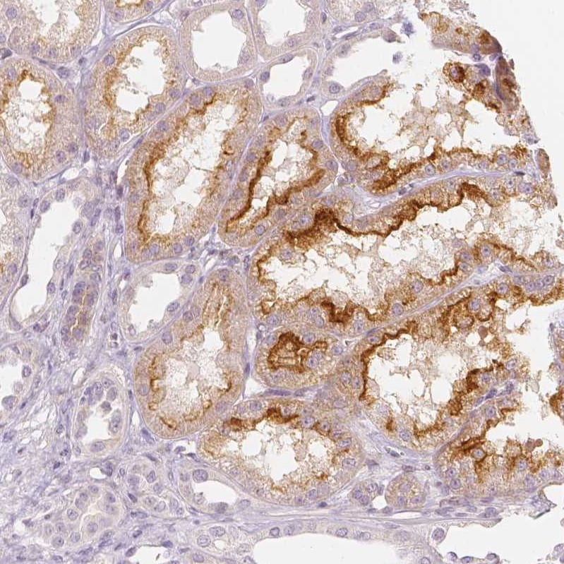 CD90/Thy1 Antibody (CL1040) - BSA Free Immunohistochemistry: CD90/Thy1 Antibody (CL1040) - BSA Free [NBP2-52961]
