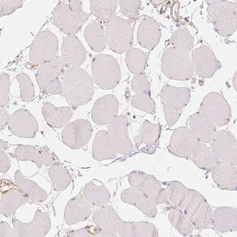 CD90/Thy1 Antibody (CL1040) - BSA Free Immunohistochemistry: CD90/Thy1 Antibody (CL1040) - BSA Free [NBP2-52961]