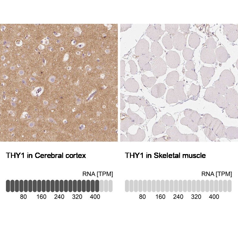 CD90/Thy1 Antibody (CL1040) - BSA Free Immunohistochemistry: CD90/Thy1 Antibody (CL1040) - BSA Free [NBP2-52961]