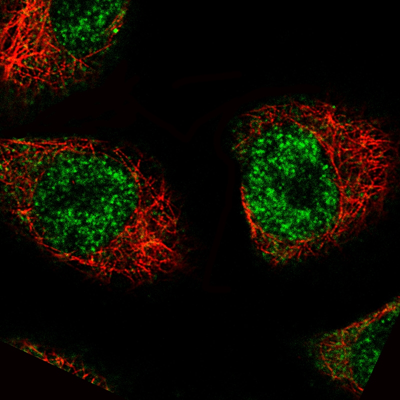 MKL2 Antibody (CL1546) - BSA Free Immunocytochemistry/ Immunofluorescence: MKL2 Antibody (CL1546) [NBP2-52970]