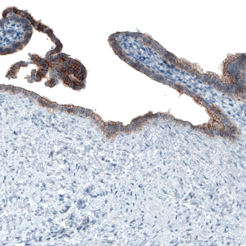 Occludin Antibody (CL1555) - BSA Free Immunohistochemistry: Occludin Antibody (CL1555) [NBP3-52455]