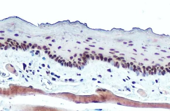 RPB2 Antibody