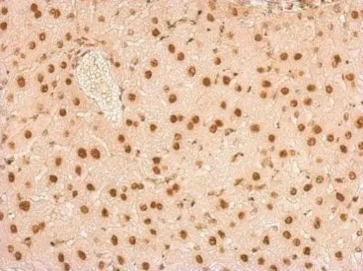 U1A Antibody