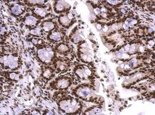 U1A Antibody