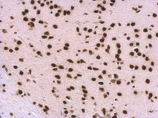 U1A Antibody