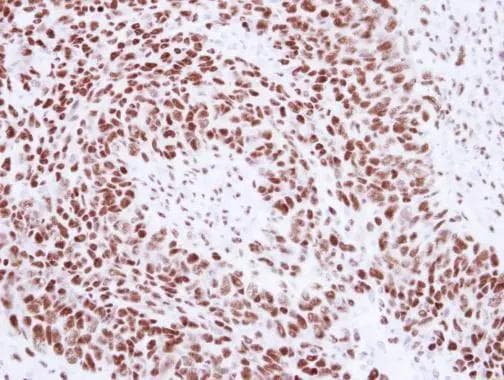 U1A Antibody