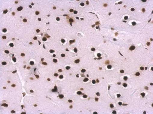 U1A Antibody