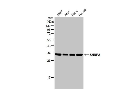 U1A Antibody