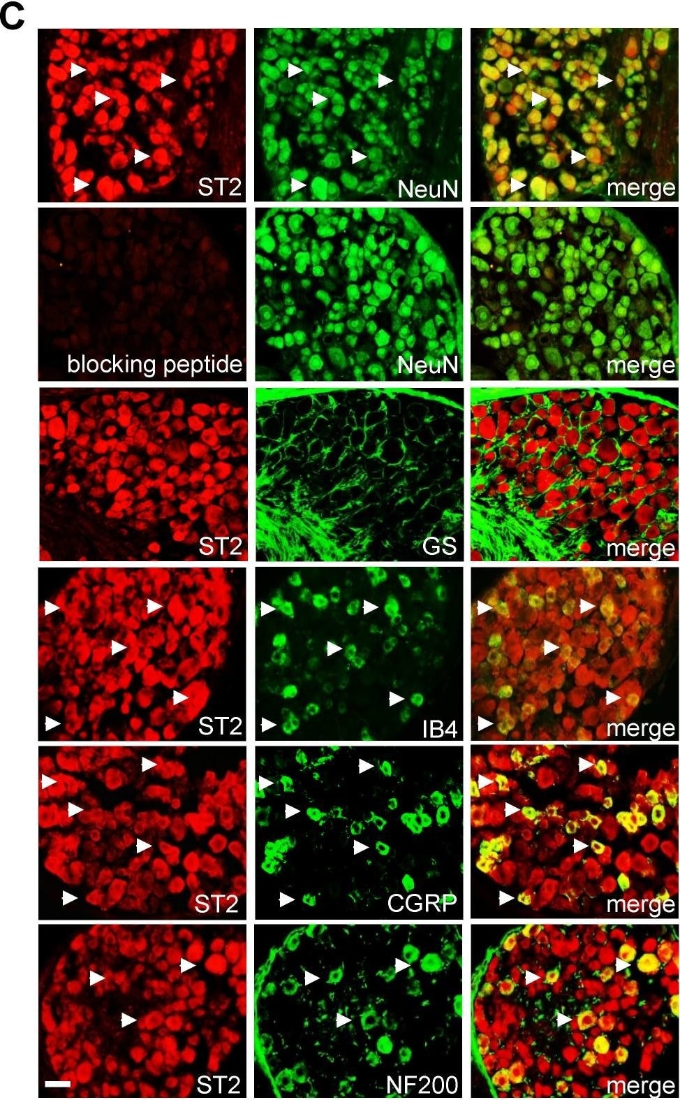 ST2/IL-33R Antibody