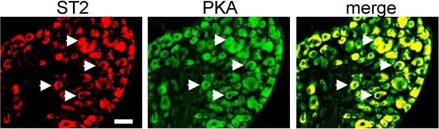 ST2/IL-33R Antibody