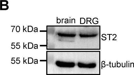 ST2/IL-33R Antibody