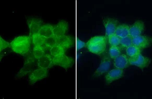 CD2AP Antibody